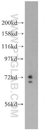 CCDC28A Antibody in Western Blot (WB)