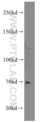 CCDC28A Antibody in Western Blot (WB)
