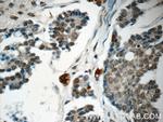 OBFC2B Antibody in Immunohistochemistry (Paraffin) (IHC (P))