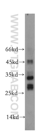 OBFC2B Antibody in Western Blot (WB)