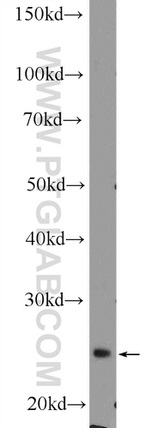 DCUN1D5 Antibody in Western Blot (WB)