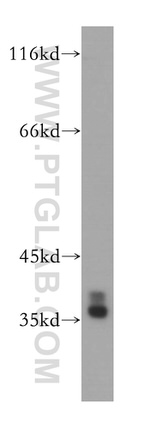 HNRNPA2B1 Antibody in Western Blot (WB)
