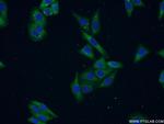 PEX16 Antibody in Immunocytochemistry (ICC/IF)