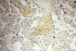MICAL1 Antibody in Immunohistochemistry (Paraffin) (IHC (P))