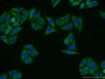 GIPC1 Antibody in Immunocytochemistry (ICC/IF)
