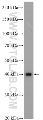GIPC1 Antibody in Western Blot (WB)