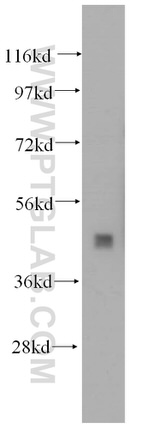 PCYT2 Antibody in Western Blot (WB)