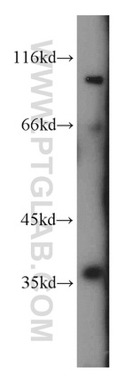 PIG3 Antibody in Western Blot (WB)