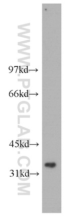 PIG3 Antibody in Western Blot (WB)