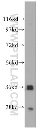 PIG3 Antibody in Western Blot (WB)