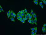 MARS Antibody in Immunocytochemistry (ICC/IF)