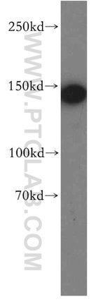 HMHA1 Antibody in Western Blot (WB)