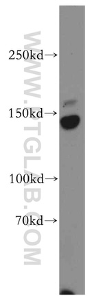 HMHA1 Antibody in Western Blot (WB)