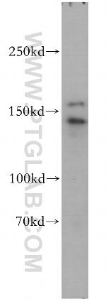 HMHA1 Antibody in Western Blot (WB)