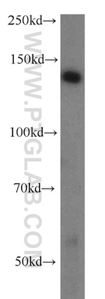 HMHA1 Antibody in Western Blot (WB)