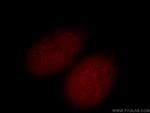 GLYR1 Antibody in Immunocytochemistry (ICC/IF)