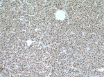 GLYR1 Antibody in Immunohistochemistry (Paraffin) (IHC (P))