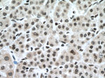 GLYR1 Antibody in Immunohistochemistry (Paraffin) (IHC (P))