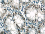 GLYR1 Antibody in Immunohistochemistry (Paraffin) (IHC (P))