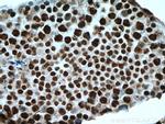 GLYR1 Antibody in Immunohistochemistry (Paraffin) (IHC (P))