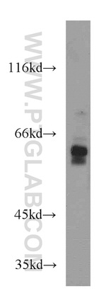 GLYR1 Antibody in Western Blot (WB)