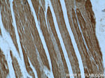 GEFT Antibody in Immunohistochemistry (Paraffin) (IHC (P))