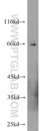 GEFT Antibody in Western Blot (WB)
