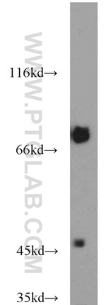 GEFT Antibody in Western Blot (WB)
