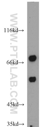 GEFT Antibody in Western Blot (WB)
