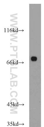 GEFT Antibody in Western Blot (WB)