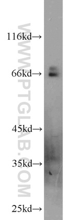 GEFT Antibody in Western Blot (WB)