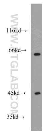 GEFT Antibody in Western Blot (WB)