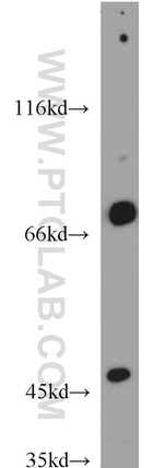 GEFT Antibody in Western Blot (WB)