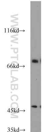GEFT Antibody in Western Blot (WB)