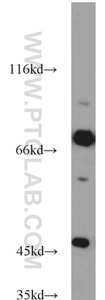 GEFT Antibody in Western Blot (WB)