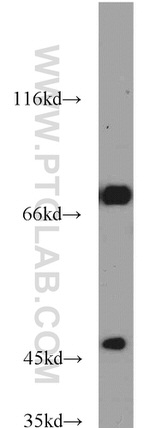 GEFT Antibody in Western Blot (WB)