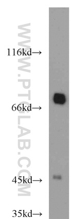 GEFT Antibody in Western Blot (WB)