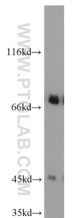 GEFT Antibody in Western Blot (WB)