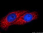 SLC25A6 Antibody in Immunocytochemistry (ICC/IF)
