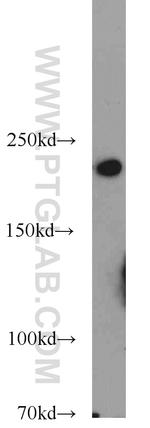 Myh9 Antibody in Western Blot (WB)