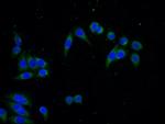 SEC61B Antibody in Immunocytochemistry (ICC/IF)