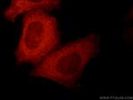 KLHL14 Antibody in Immunocytochemistry (ICC/IF)