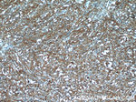 KLHL14 Antibody in Immunohistochemistry (Paraffin) (IHC (P))