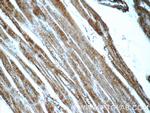 KLHL14 Antibody in Immunohistochemistry (Paraffin) (IHC (P))