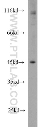 KLHL14 Antibody in Western Blot (WB)