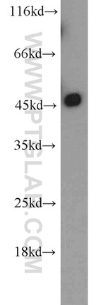 KLHL14 Antibody in Western Blot (WB)