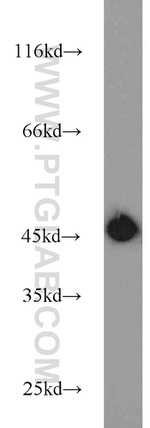 KLHL14 Antibody in Western Blot (WB)