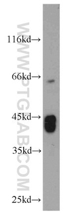KLHL14 Antibody in Western Blot (WB)