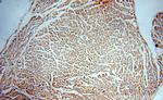 Collagen Type VI Antibody in Immunohistochemistry (Paraffin) (IHC (P))