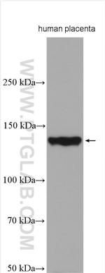 Collagen Type VI Antibody in Western Blot (WB)